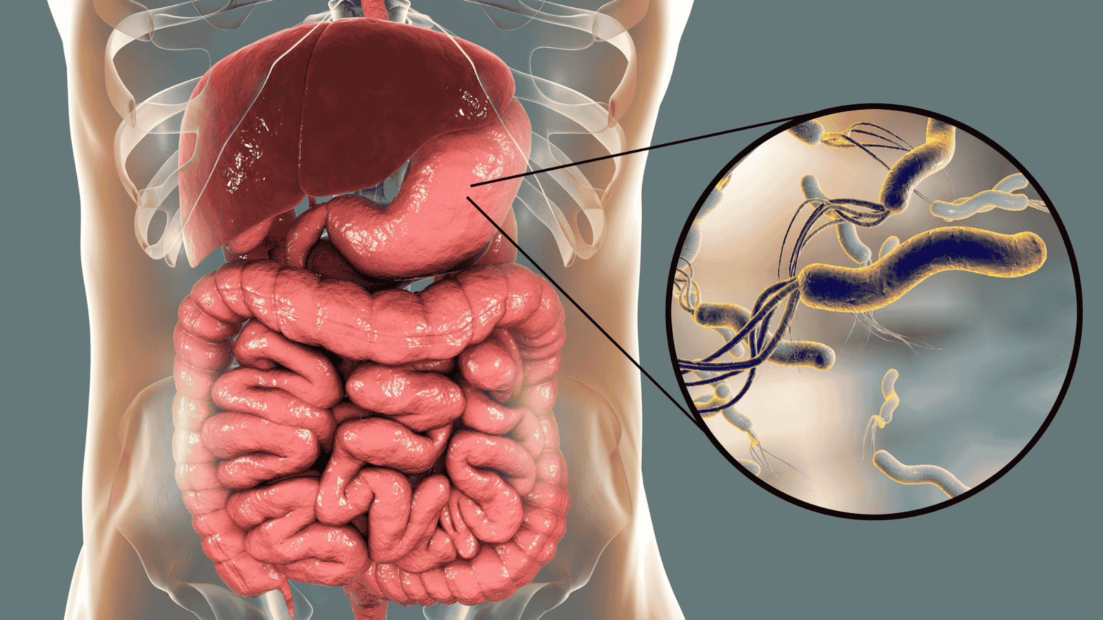 H. Pylori e Saúde Gástrica